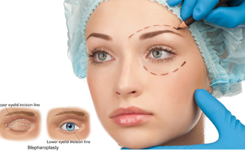 SAU PHẪU THUẬT VÙNG MẮT