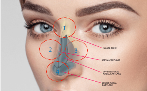 SAU TẠO HÌNH MŨI